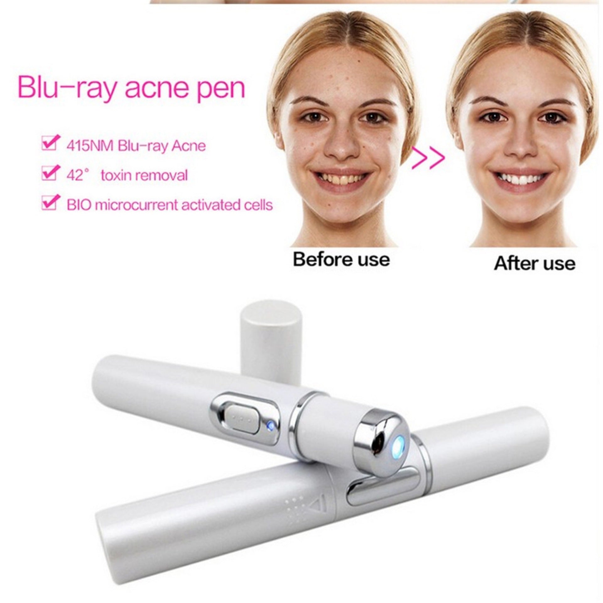 HeyGlow Blue Light Therapy Acne Laser Pen